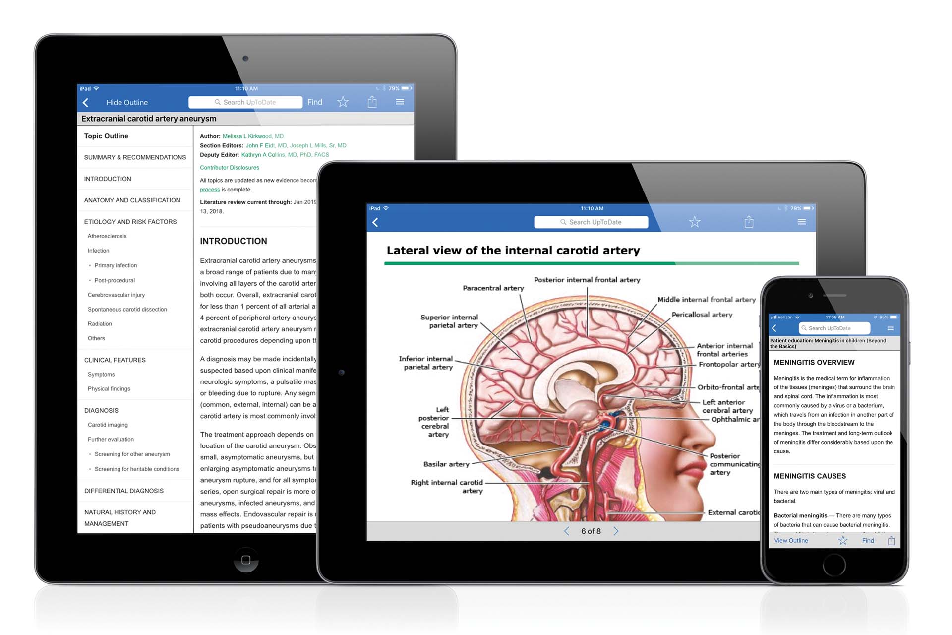 uptodate-wolters-kluwer