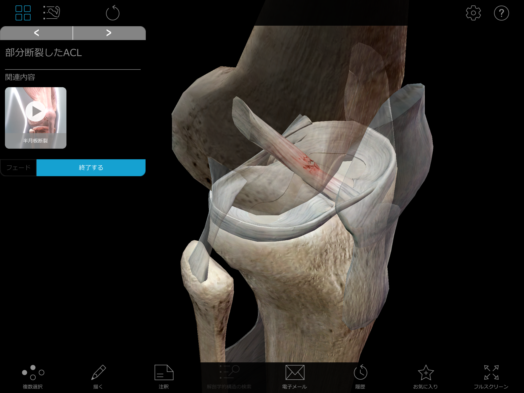 Visible Body Muscle Premium 筋肉プレミアム Ovid Wolters Kluwer